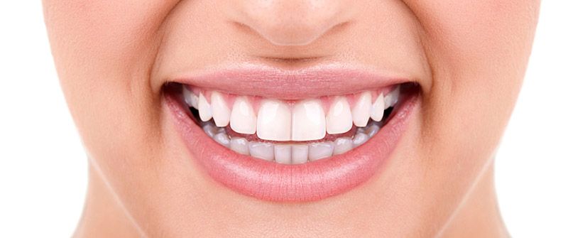 Lo que debes saber acerca de las carillas dentales - ODONTOVALLE